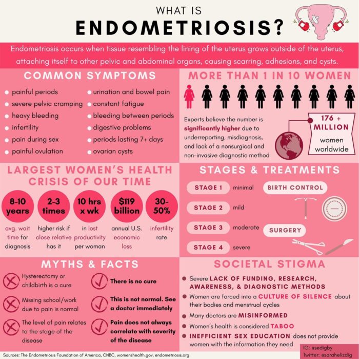Health & Wellness // What It’s Like Living With Endometriosis | …love ...